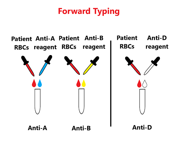 Forward typing