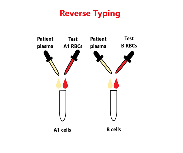 process of blood typing