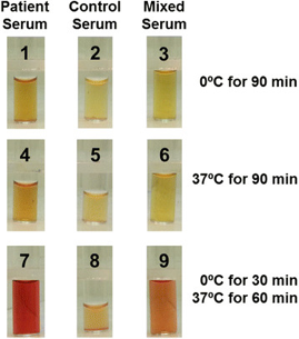 Serum tubes